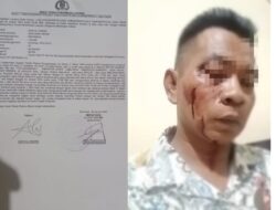 2 Oknum Ustad Diduga Lakukan Pengeroyokan Brutal Terhadap Wartawan Sumenep 